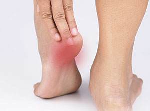 Patient suffering from plantar fasciitis